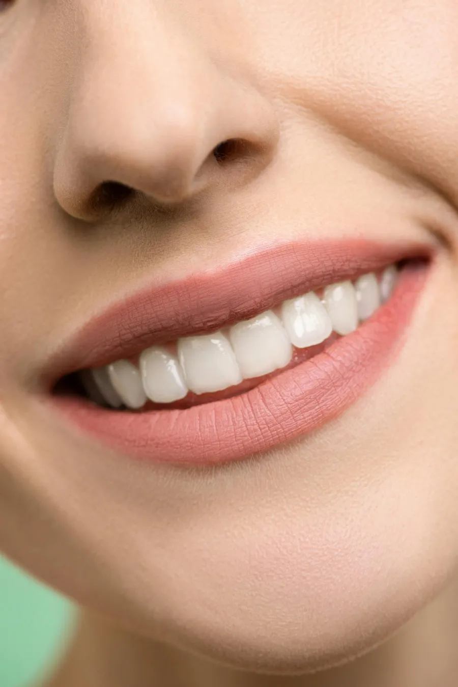 Close-up of a natural-looking smile after veneer treatment