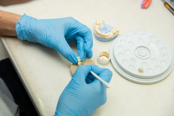 Dental laboratory technician using precision tools to craft a veneer restoration