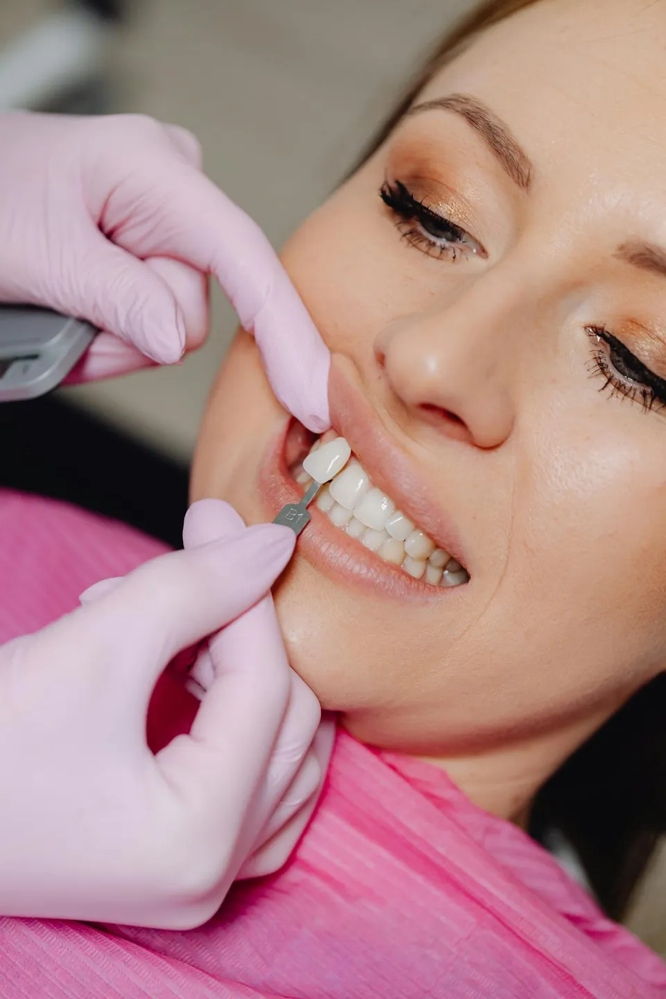 Smile design procedure in progress